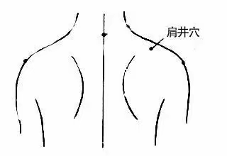 肩颈疼痛    医案记录（一）