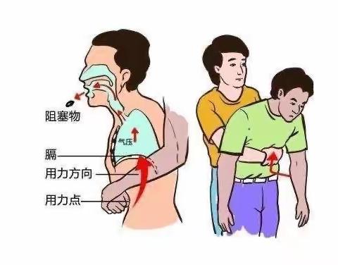 【卫生保健】七步洗手法和海姆立克急救法——-大风车幼儿园